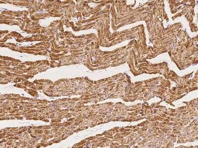 Immunohistochemistry-Paraffin: Phospholamban Antibody [NBP2-97463]