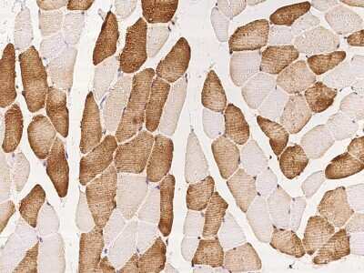 Immunohistochemistry-Paraffin: Phospholamban Antibody [NBP2-97463]