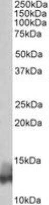 Western Blot: Phospholamban Antibody [NBP1-49852]