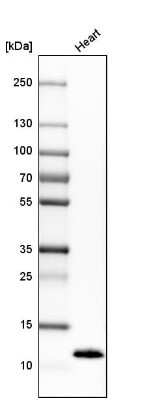 Western Blot: Phospholamban Antibody [NBP1-85543]