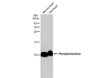 Western Blot: Phospholamban Antibody [NBP2-19807]