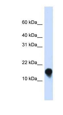 Western Blot: Phospholemman Antibody [NBP1-79193]