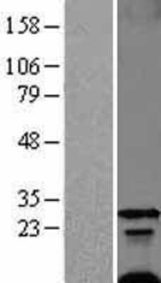 Western Blot: Phospholemman Overexpression Lysate [NBL1-10875]