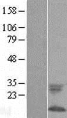 Western Blot: Phospholemman Overexpression Lysate [NBL1-10876]