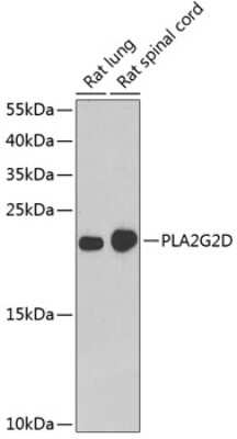 Western Blot: Phospholipase A2 IID AntibodyBSA Free [NBP2-93007]