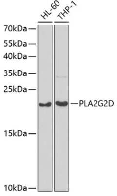 Western Blot: Phospholipase A2 IID AntibodyBSA Free [NBP2-94062]