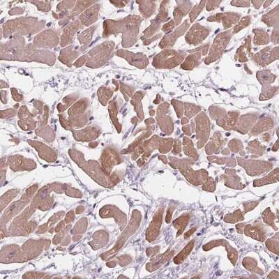 Immunohistochemistry-Paraffin: Phospholipase A2 IIE Antibody [NBP2-38042]