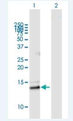 Western Blot: Phospholipase A2 IIE Antibody [H00030814-B01P-50ug]