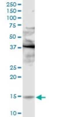 Western Blot: Phospholipase A2 IIE Antibody [H00030814-D01P]