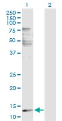 Western Blot: Phospholipase A2 IIE Antibody [H00030814-D01P]