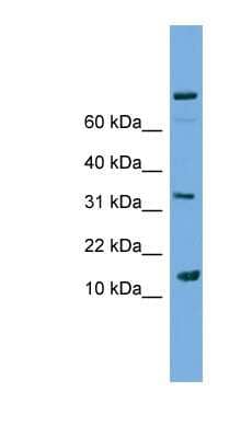 Western Blot: Phospholipase A2 IIE Antibody [NBP1-79199]