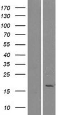 Western Blot: Phospholipase A2 IIE Overexpression Lysate [NBP2-10315]