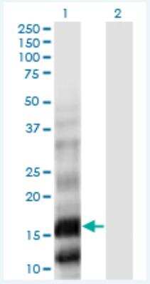 Western Blot: Phospholipase A2 X Antibody (5G11) [H00008399-M01-100ug]