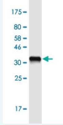 Western Blot: Phospholipase A2 X Antibody (5G11) [H00008399-M01-100ug]