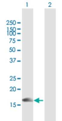 Western Blot: Phospholipase A2 X Antibody [H00008399-B01P]