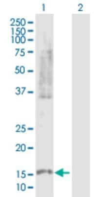 Western Blot: Phospholipase A2 X Antibody [H00008399-D01P]