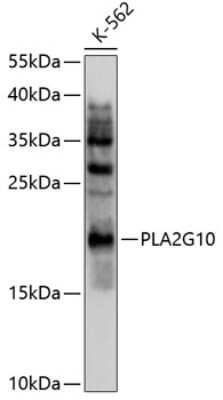 Western Blot: Phospholipase A2 X AntibodyBSA Free [NBP2-93378]