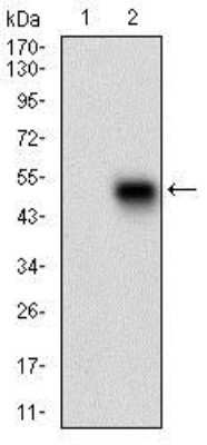 Western Blot: Phospholipase A2 XII Antibody (3H2C11)BSA Free [NBP2-37255]