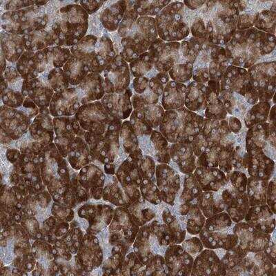 Immunohistochemistry: Phospholipase A2 XII Antibody [NBP1-87265]