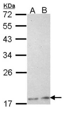 Western Blot: Phospholipase A2 XII Antibody [NBP1-31693]