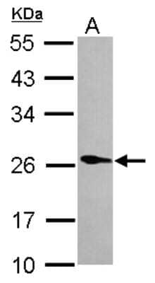 Western Blot: Phospholipase A2 XII Antibody [NBP2-19808]