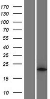 Western Blot: Phospholipase A2 XII Overexpression Lysate [NBP2-06175]