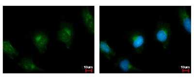 Immunocytochemistry/ Immunofluorescence: PLA2G4A Antibody [NBP2-19809]