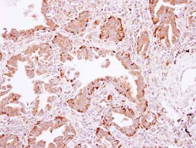 Immunohistochemistry-Paraffin: PLA2G4A Antibody [NBP2-19809]