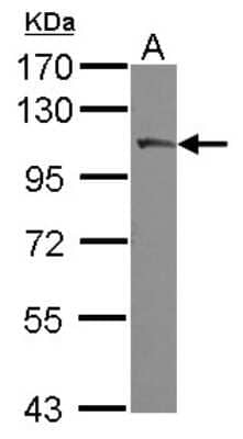 Western Blot: PLA2G4A Antibody [NBP2-19809]