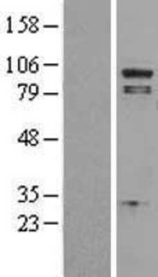 Western Blot: PLA2G4A Overexpression Lysate [NBL1-14474]