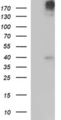 Western Blot: Phospholipase B1 Antibody (OTI1D3) [NBP2-46441]