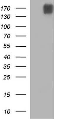 Western Blot: Phospholipase B1 Antibody (OTI1B3)Azide and BSA Free [NBP2-73385]