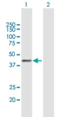 Western Blot: Phospholipase B1 Antibody [H00151056-B01P]