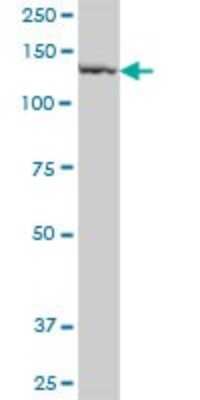 Western Blot: Phospholipase B1 Antibody [H00151056-B02P]