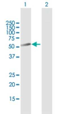 Western Blot: Phospholipase B1 Antibody [H00151056-B02P]