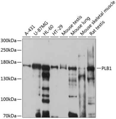 Western Blot: Phospholipase B1 AntibodyBSA Free [NBP2-93485]