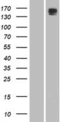 Western Blot: Phospholipase B1 Overexpression Lysate [NBP2-05291]