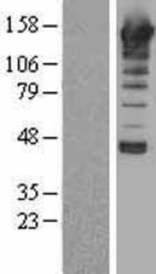 Western Blot: PLC-beta 1 Overexpression Lysate [NBL1-14488]