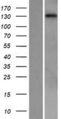 Western Blot: PLC-beta 1 Overexpression Lysate [NBP2-04807]