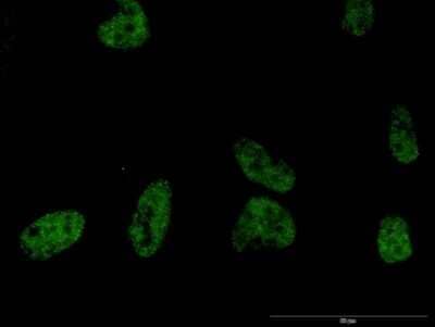 Immunocytochemistry/ Immunofluorescence: Phospholipase C beta 2 Antibody (1B3) [H00005330-M03]