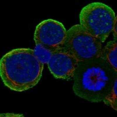 Immunocytochemistry/ Immunofluorescence: Phospholipase C beta 2 Antibody [NBP3-17086]