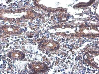 Immunohistochemistry-Paraffin: Phospholipase C beta 2 Antibody [NBP3-13288]