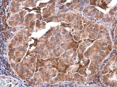 Immunohistochemistry-Paraffin: Phospholipase C beta 2 Antibody [NBP3-13288]