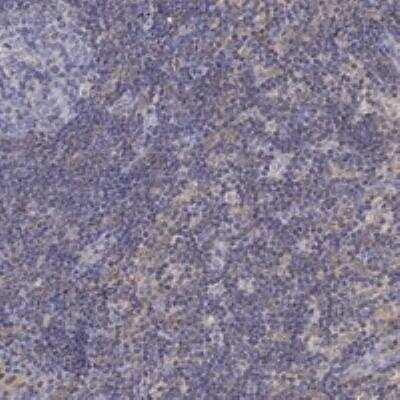 Immunohistochemistry-Paraffin: Phospholipase C beta 2 Antibody [NBP3-17086]