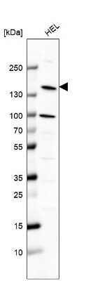 Western Blot: Phospholipase C beta 2 Antibody [NBP2-58951]