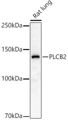 Western Blot: Phospholipase C beta 2 AntibodyAzide and BSA Free [NBP2-93815]