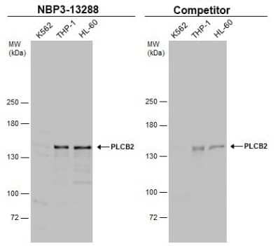 Western Blot: Phospholipase C beta 2 Antibody [NBP3-13288]