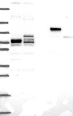 Western Blot: Phospholipase C beta 2 Antibody [NBP3-17086]