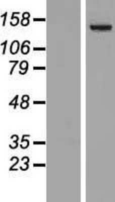 Western Blot: PLC-beta 4 Overexpression Lysate [NBL1-14489]