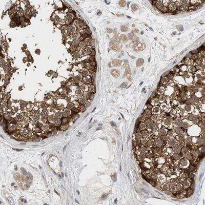 Immunohistochemistry: Phospholipase C delta 1 Antibody [NBP1-87557]